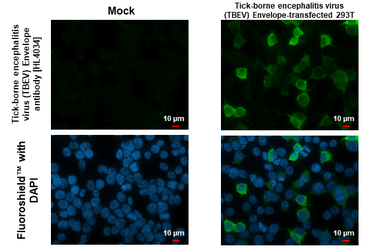 Anti-Tick-borne encephalitis virus (TBEV) Envelope antibody [HL4034] used in Immunocytochemistry/ Immunofluorescence (ICC/IF). GTX642365